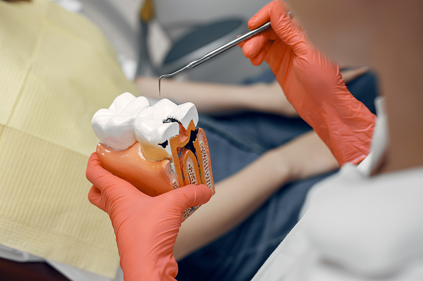 Understanding Root Canal Treatment Cost and Quality
